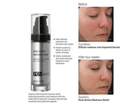 PCA SKIN Dual Action Redness Relief Serum